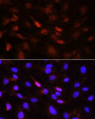 Immunocytochemistry/Immunofluorescence: Jak1 [p Tyr1022, p Tyr1023] Antibody [NBP3-05436] - Immunofluorescence analysis of NIH/3T3 cells using Jak1 antibody (NBP3-05436) at dilution of 1:100. Blue: DAPI for nuclear staining.